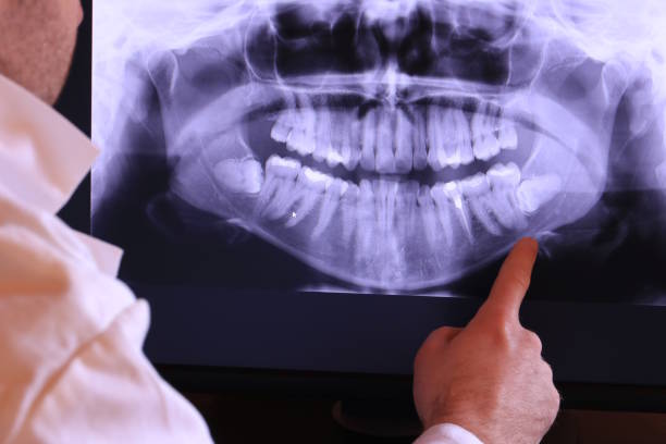 Best Emergency Treatment for Oral Infections in Farmersville, TX