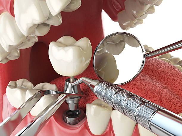 Best Emergency Cosmetic Dentistry (e.g., broken veneers) in Farmersville, TX